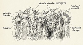 giardia in the intestine