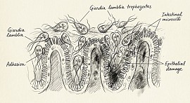 Giardia